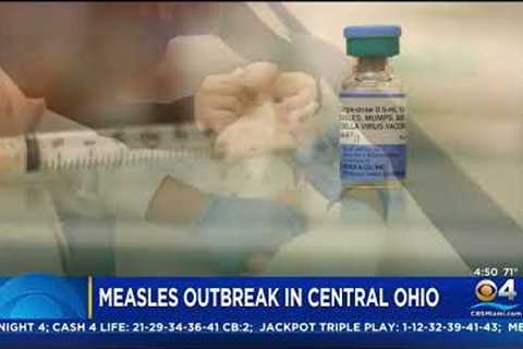 Measles Outbreak in Ohio